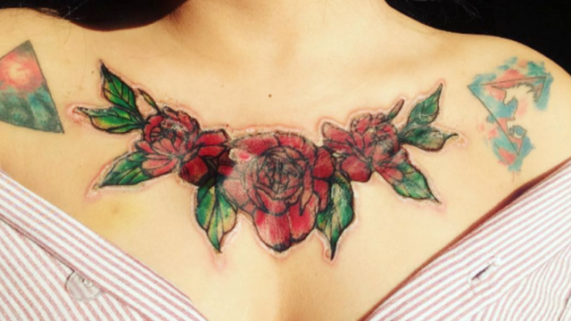 GRAPHIC: Woman Has The Most Horrific Injury After Getting Tattoo Removal!