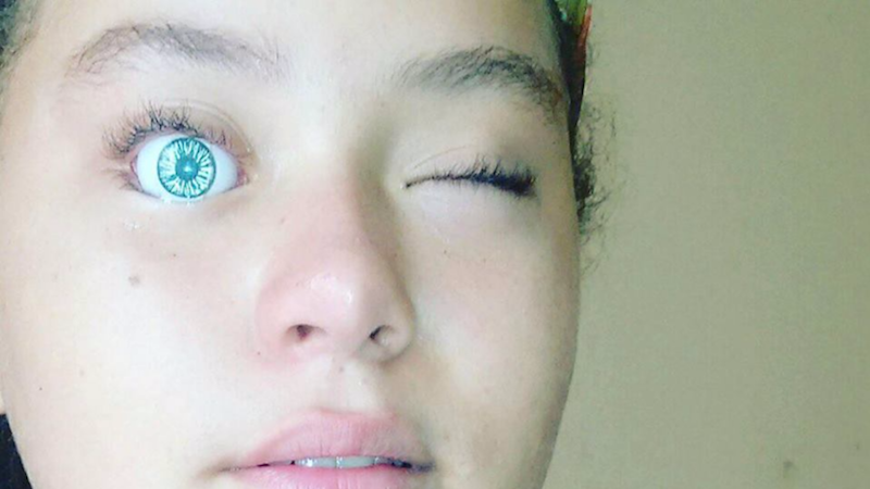 Girl Puts Doll’s Eye Into Her Own Eye Socket, Immediately Regrets Decision