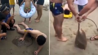 Poor bloke gets stung on the dick by stingray