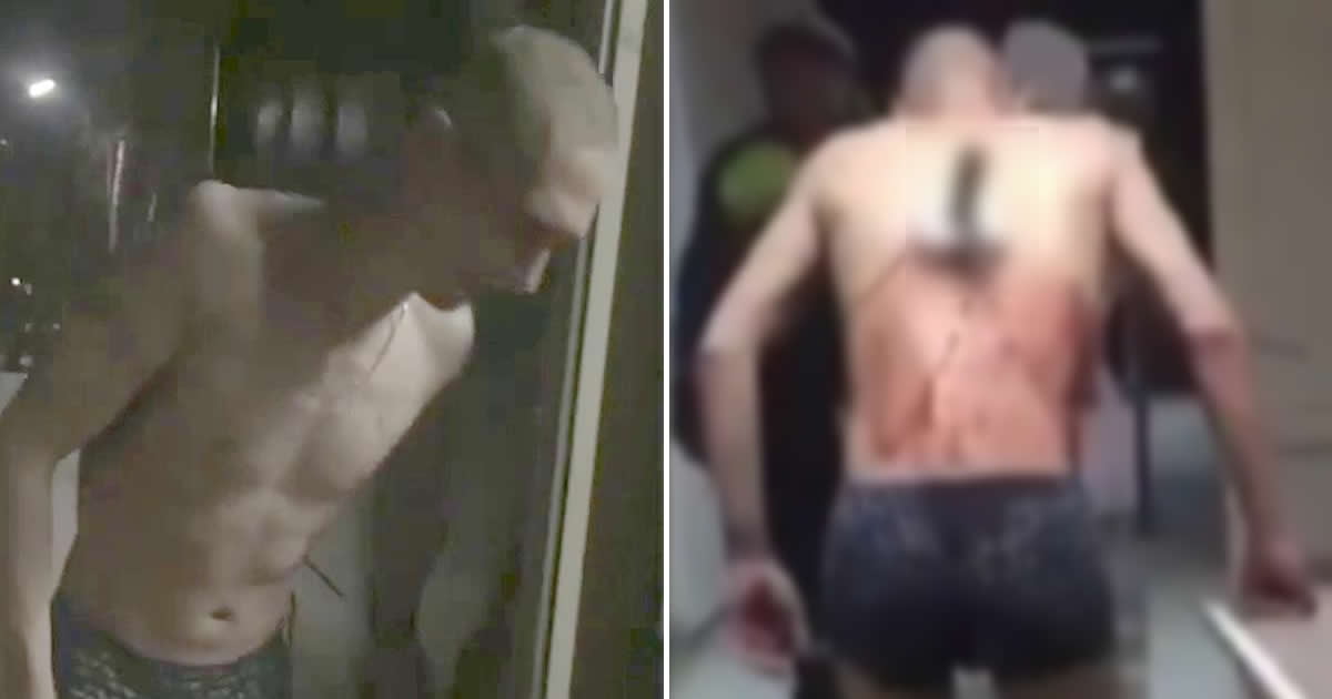 Shirtless Russian bloke with knife in back leaves hospital for a durry in the freezing
