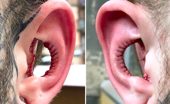 People are taking body piercing up a notch in 2019