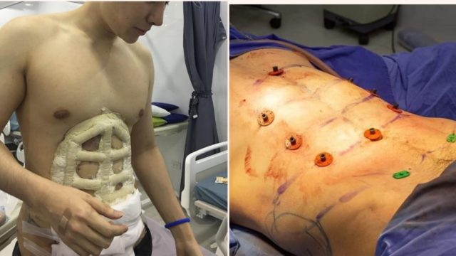 This Hospital is offering instant six-pack surgery and it’s pretty f**ken weird
