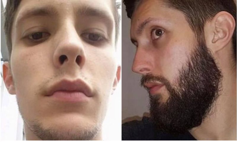 Blokes desperate to grow beards claim to have found a remedy for patchy face hair!