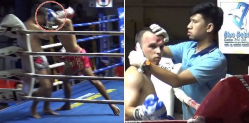 Reliving the Muay Thai fighter who had his head caved in by a ‘hellbow’