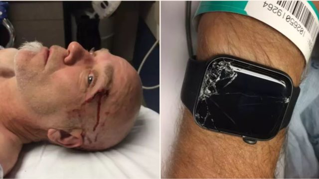 Bloke left unconscious and alone in the woods until Apple Watch saved his life