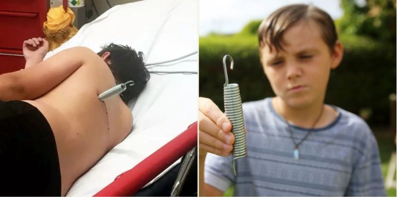 Kid gets speared by metal spring during trampoline accident