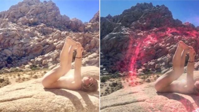 Doctors have warned against new ritual of ‘bum-sunning’