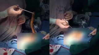 Bloke has eel removed from ‘nether regions’ after prank goes wrong