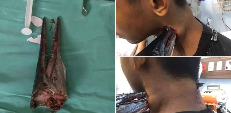 Fish says “Yeah Nah” to young fisherman