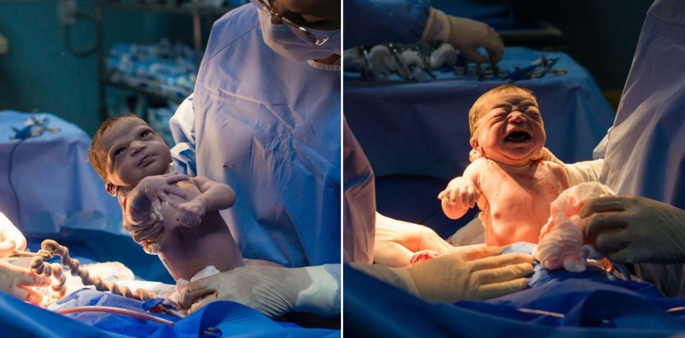Photos of newborn baby frowning at Doctor who was trying to make it cry go viral