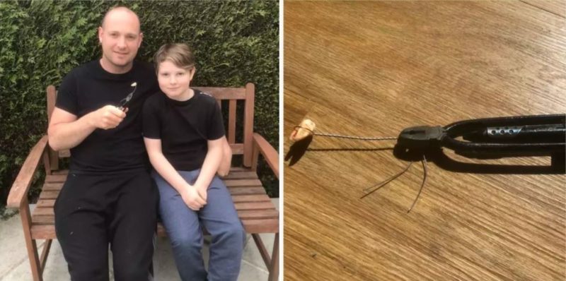 Desperate dad extracts his own tooth with a pair of pliers