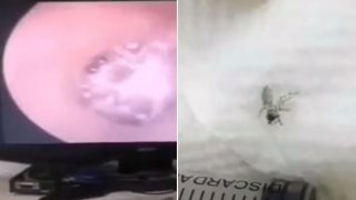 Doctors film spider spinning web in sheila’s ear-canal