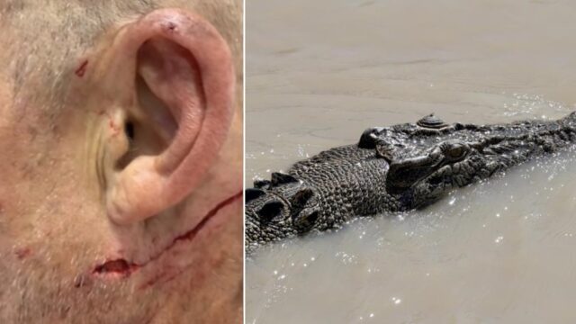 “He had puncture marks on his head”: Bloke escapes jaws of crocodile