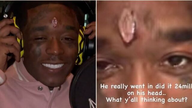 Rapper Lil Uzi Vert gets a $24 million diamond pierced to his forehead