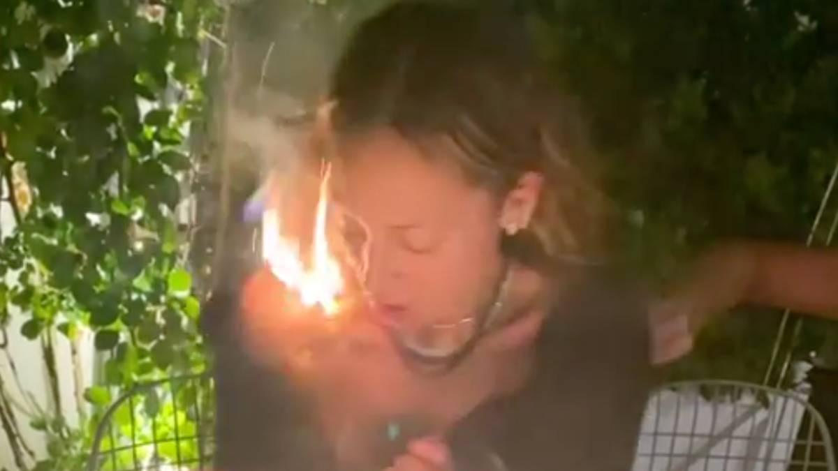 Nicole Ritchie accidentally sets her hair on fire while trying to blow out birthday candles