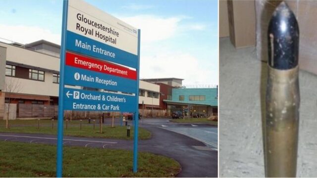 Bomb squad rushes to hospital after WWII-era shell found in man’s rectum