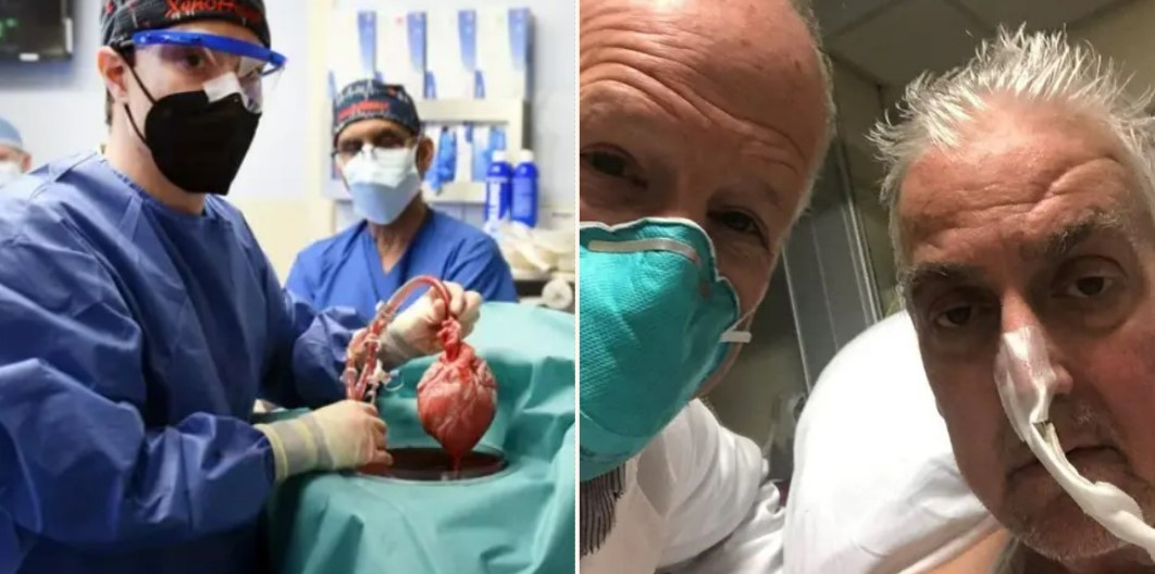 US bloke receives first pig-human heart transplant