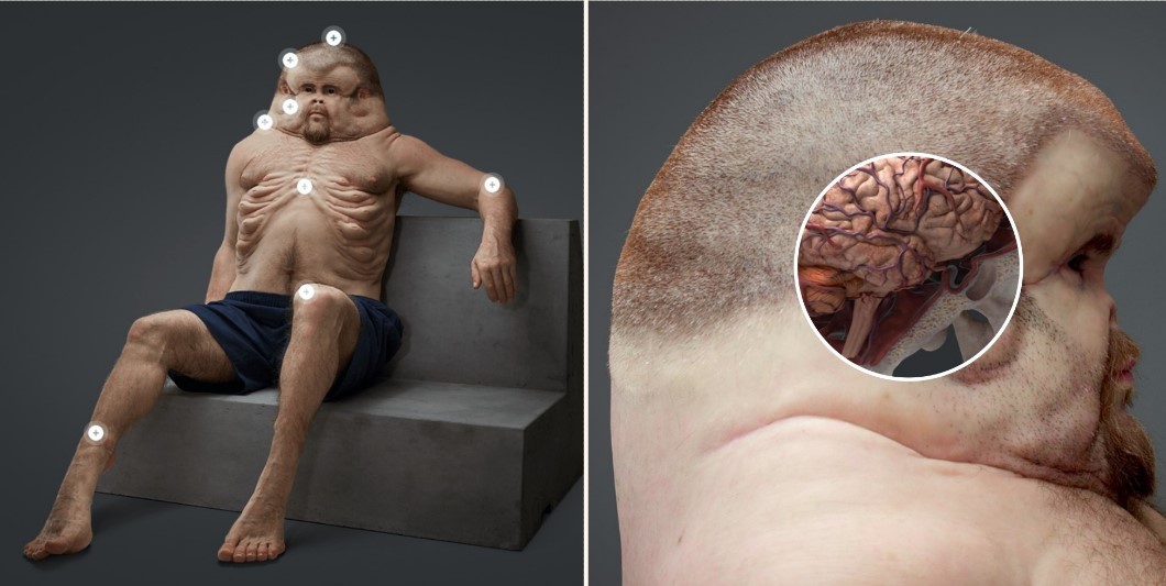 Mutant “Superhuman” shows how people would need to look to survive car crashes